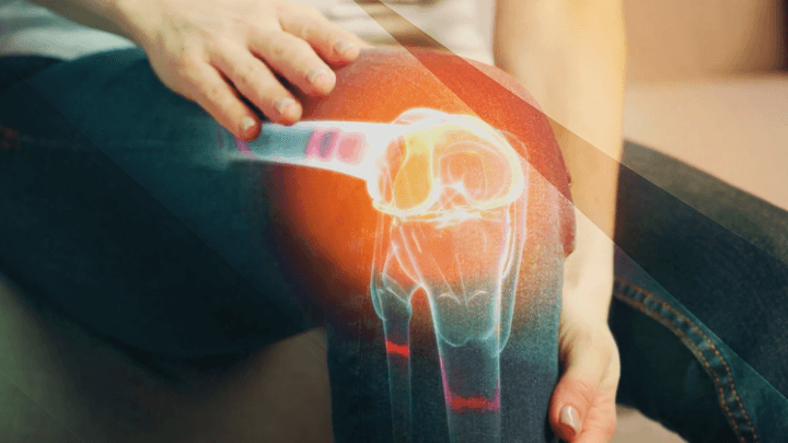 Woman holding her knee with an X-ray image of the bone projected onto it.