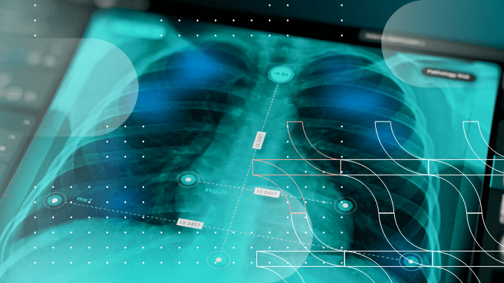 Chest X-ray with data overlays.