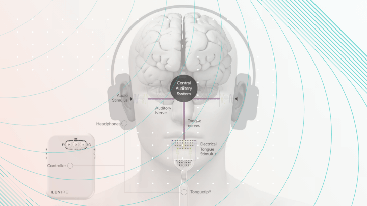 Medical device for brain stimulation.