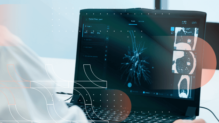 Doctor reviewing a digital CT scan of lungs on a laptop.